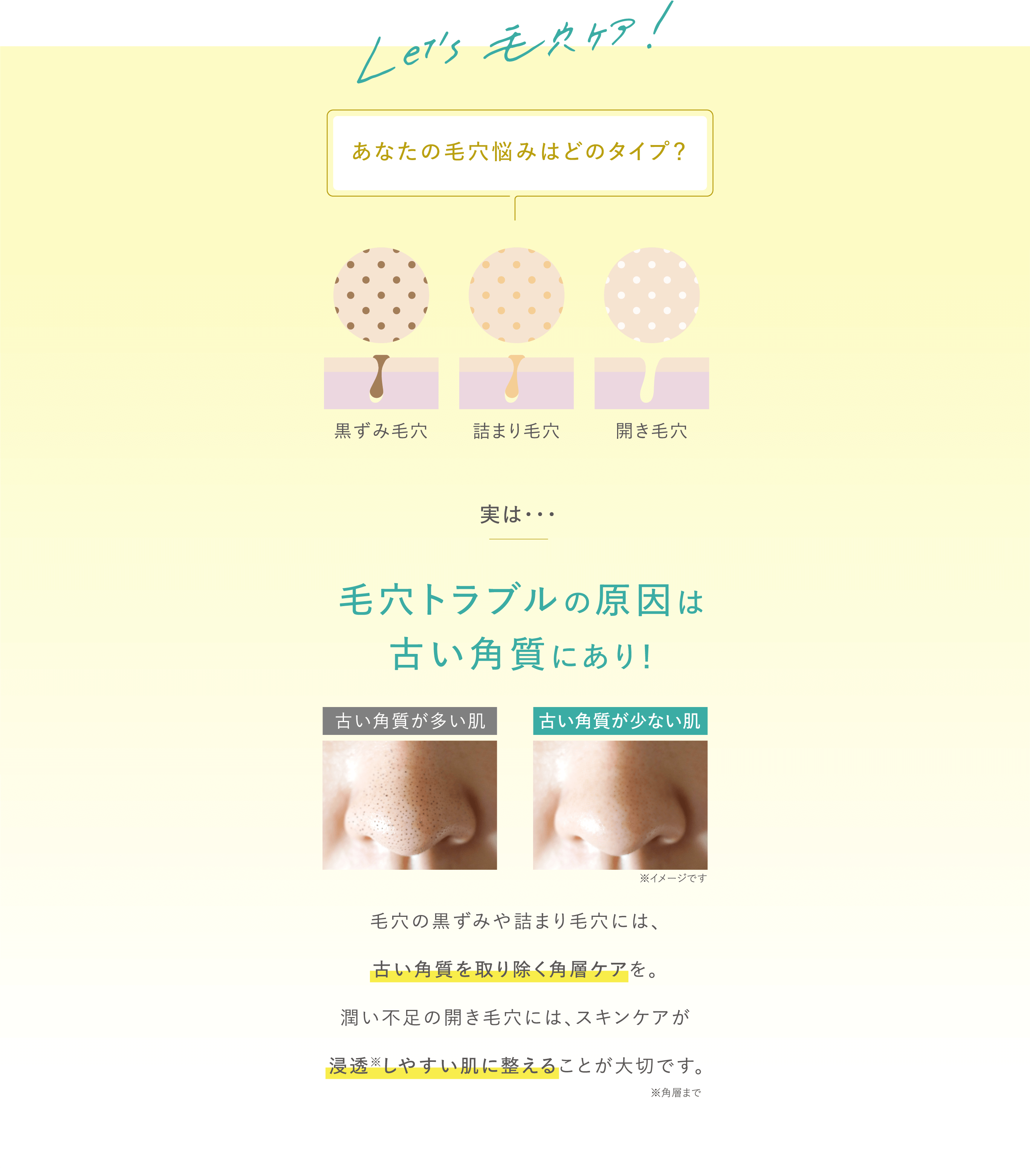 Let'S
          毛穴ケア！あなたの毛穴悩みはどのタイプ？