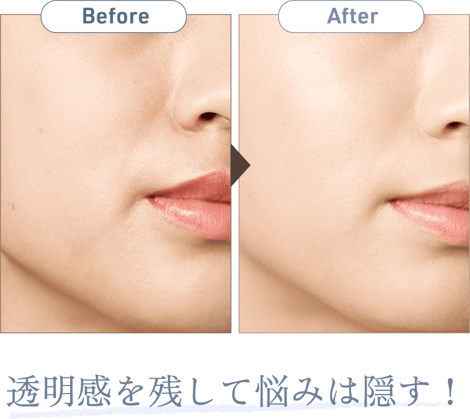Before After透明感を残して悩みは隠す!