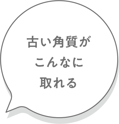 古い角質がこんなに取れる
