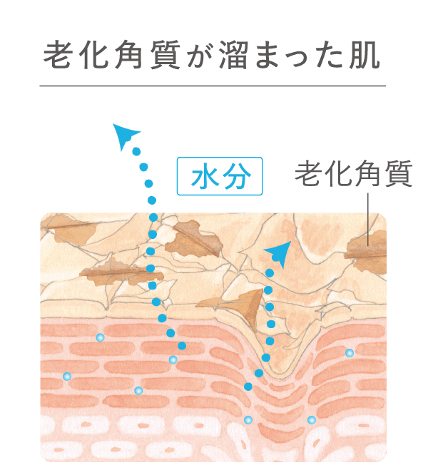 老化角質が溜まった肌